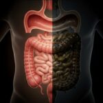 What is Ama? Uncovering the Root of Disease in Ayurveda (And How to Eliminate It) What is Ama? The Ayurvedic Root of Disease & How to Fix It